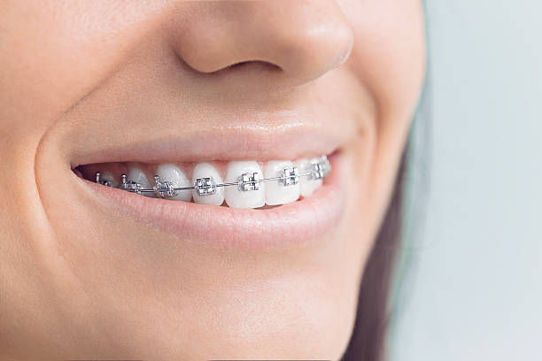 Dental X-Rays and Imaging in Cold Spring, MN